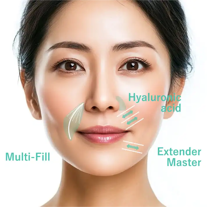 段差にアプローチする段差（ダンチャ）