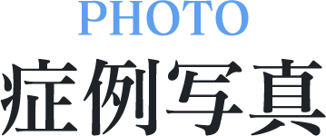 症例写真