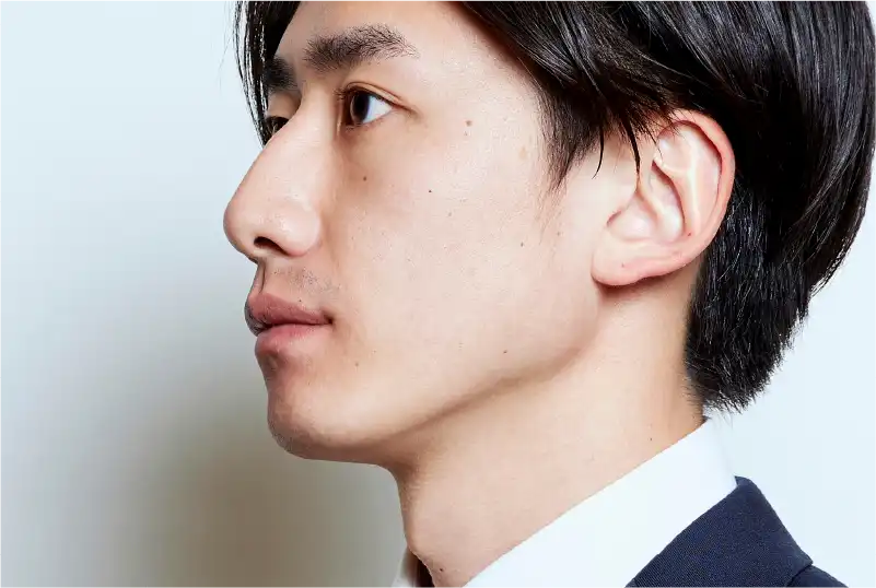 顔のたるみ / フェイスライン