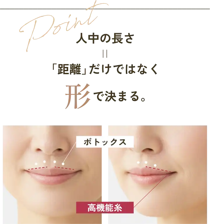 人中の長さ＝「距離」だけではなく形で決まる