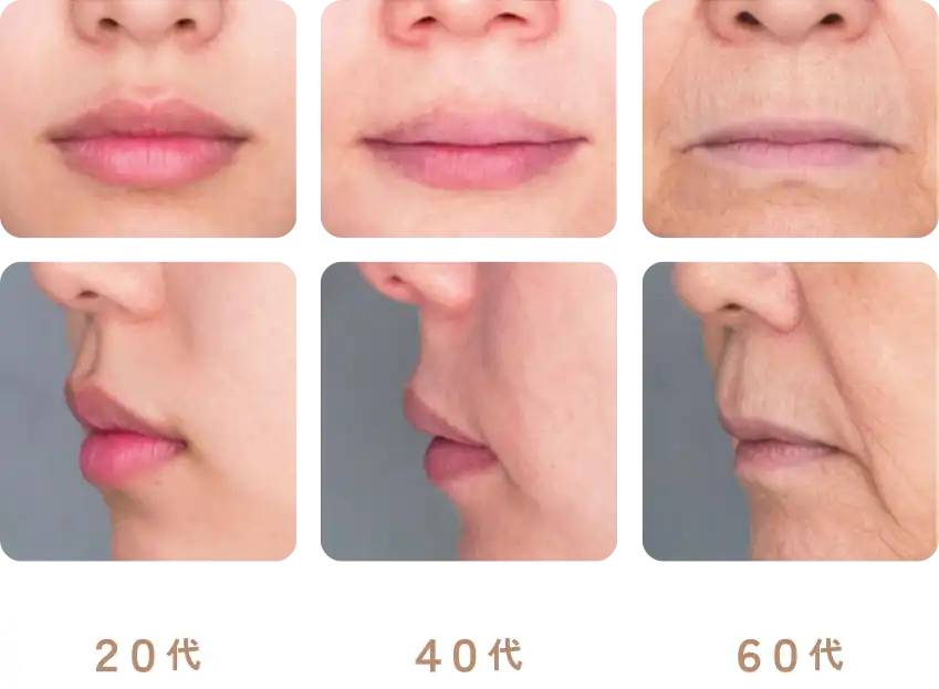 バーミリオンボーダー