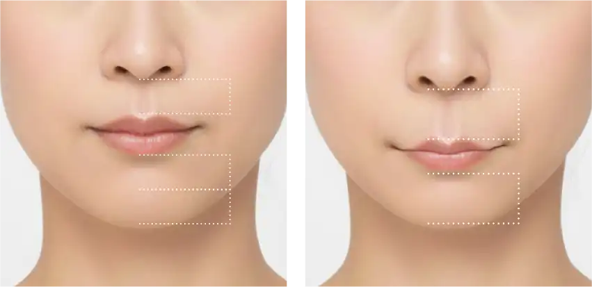 人中が長い特徴