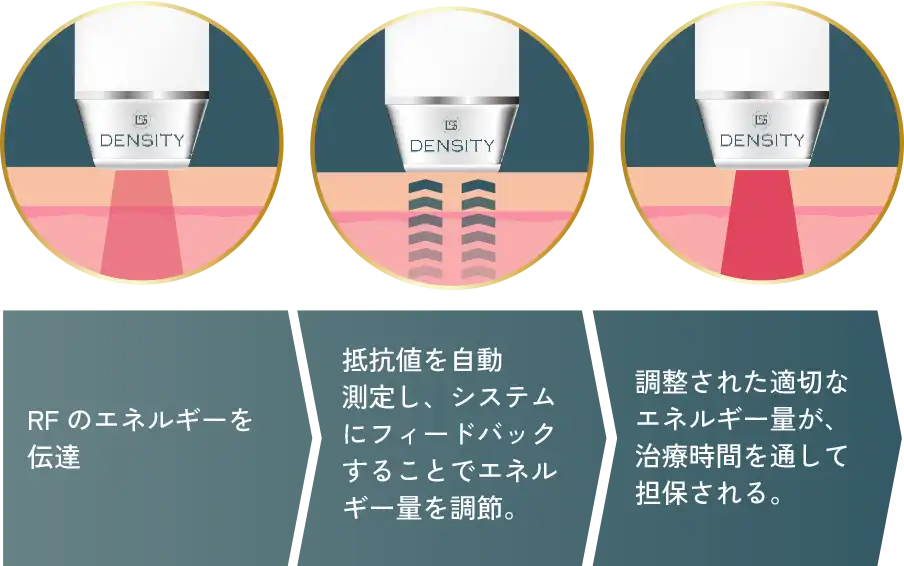 肌の状態を都度確認し、均一なエネルギーを照射