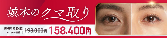 城本のクマ取り