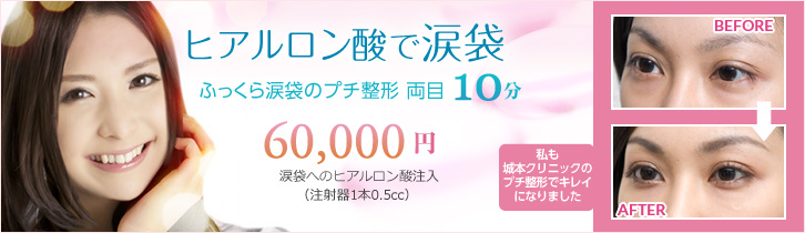 ヒアルロン酸で涙袋